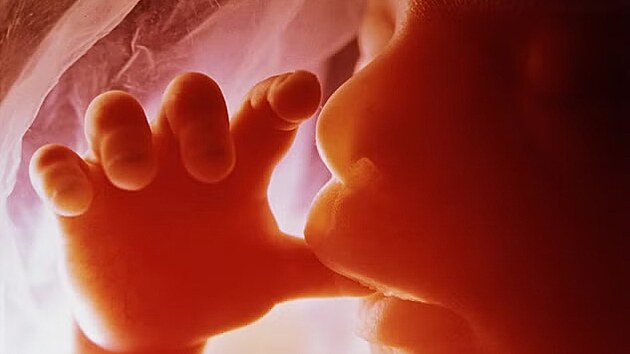 Ze s�rie sn�mk� Drama �ivota p�ed narozen�m �v�dsk�ho fotografa Lennarta Nilssona