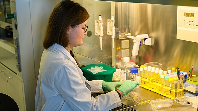 V�voj modelu tenk�ho st�eva na Univerzit� Tom�e Bati ve Zl�n�. Monika Muchov� p�ipravuje �elatinu pro budouc� um�l� tenk� st�evo. (leden 2026)