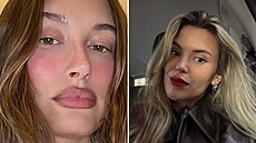 Kdy� se slavné �eny rozhodnou pro zm�nu tvaru rt�.