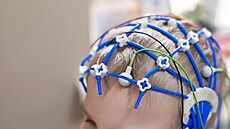 Ilustra�ní fotografie