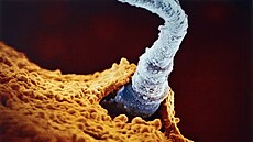 Ze série snímk� Drama �ivota p�ed narozením �védského fotografa Lennarta...