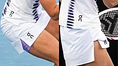 Úvodní kolo Australian Open p�ineslo pro Igu �wiatekovou ne�ekanou komplikaci....