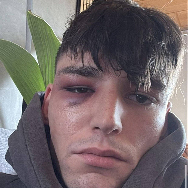 Žádost o ruku na stadionu měla smutnou dohru. Rozhodčího zbili ve vlastním domě