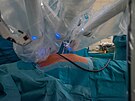 Olomouck� fakultn� nemocnice za�ala p�i operac�ch bypassu vyu��vat robotick�...