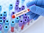 ilustra�ní snímek