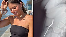 Bizarní nehoda mohla �enu stát �ivot. Stáli p�i ní v�ichni svatí.