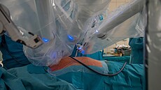 Olomoucká fakultní nemocnice za�ala p�i operacích bypassu vyu�ívat robotický...