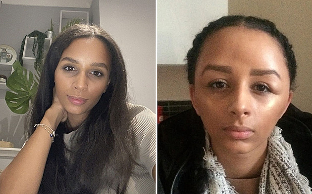 Alergická reakce na barvu na vlasy ženu málem zabila