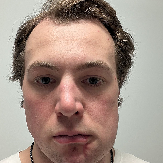 Přijde odplata? V NHL se loučili brutálním hitem, v Miláně si ale musí dávat pozor