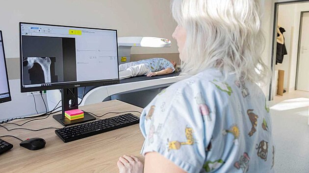 Osteologick� ambulance v Krajsk� nemocnici Tom�e Bati zaji��uje komplexn� p��i v�etn� vy�et�en� na denzitometru.