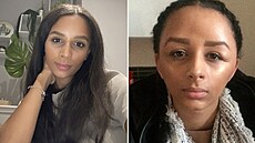 �ena má na alergické reakce opravdu ��t�stí�.