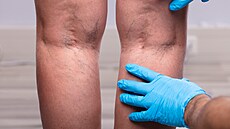 Ilustra�ní fotografie