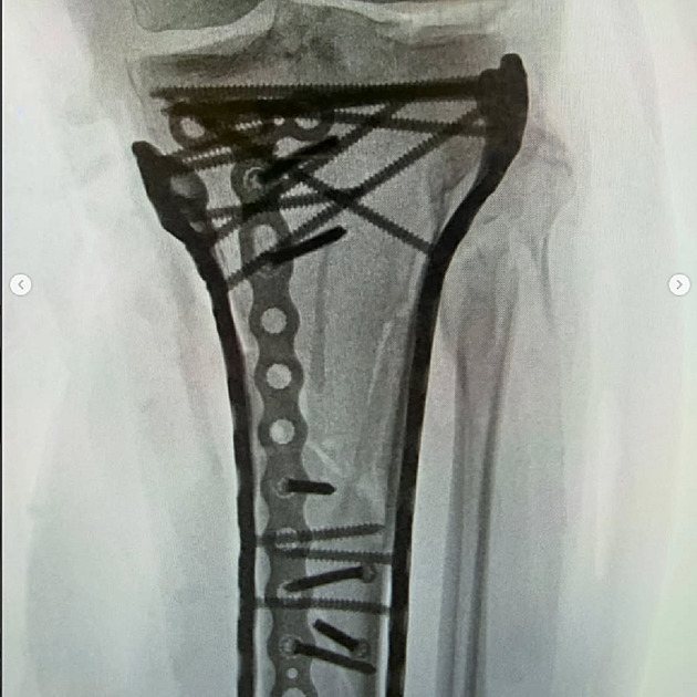 Rychlejší nějakou dobu nebudu. Vonnové pomáhají s pohybem nová kolečka