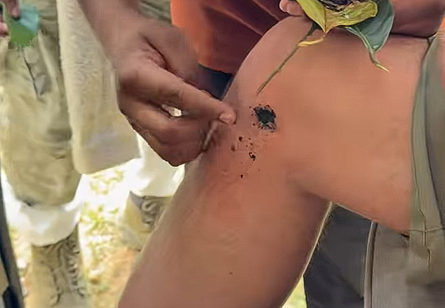 Sidovského s Vítkem potrápily na Srí Lance tropické pijavice i přeražený nos