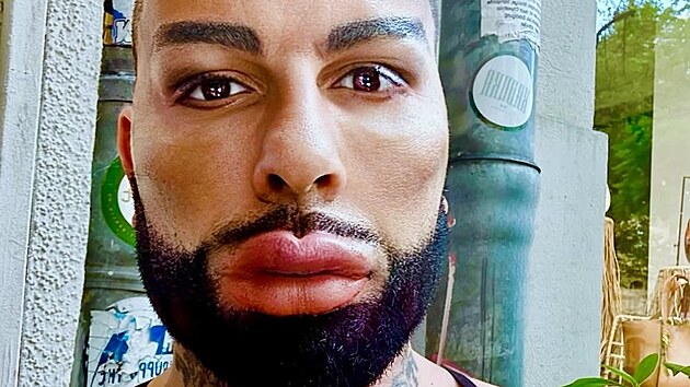 Harald Gl��ckler