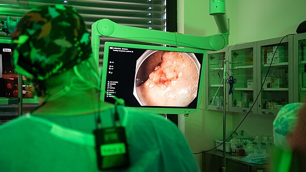 V olomouck� fakultn� nemocnici p�ibyla nov� vy�et�ovna i nov� �chytr� kolonoskopy, vyu��vaj�c� um�l� inteligence pro detekci mal�ch polyp�.