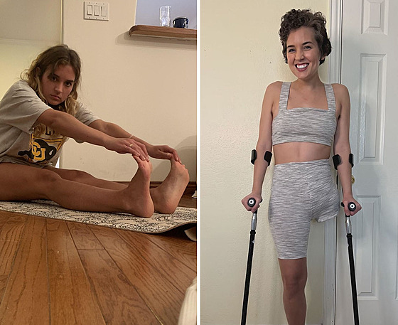 �ena skon�ila s amputovanou nohou.