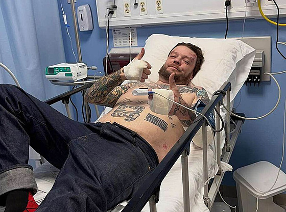 Corey Harrison zve�ejnil snímky z mexické nemocnice po nehod� na motorce