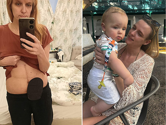 Ženu posílali domů s bolestmi, v břiše však měla několik nádorů