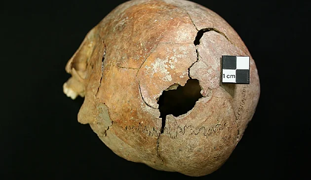 Brutální tajemství doby železné. Masový hrob ukrýval ostatky žen a dětí