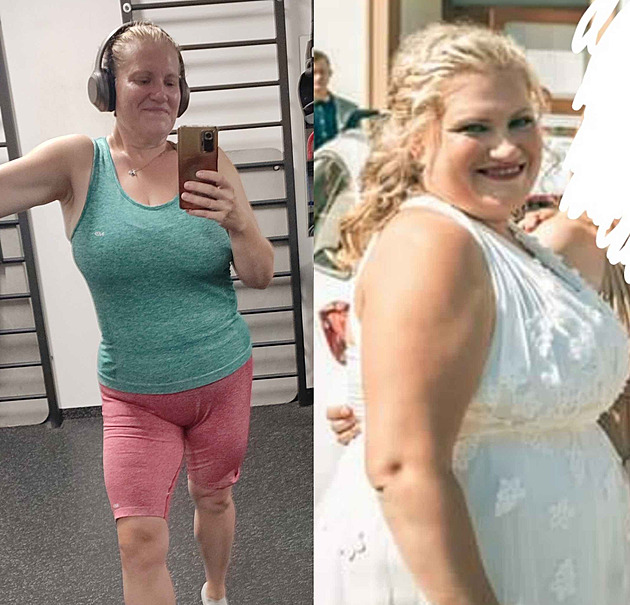 Hubnutí s lékařem je úspěšnější, tvrdí odborníci. Pomáhá i nový typ operace