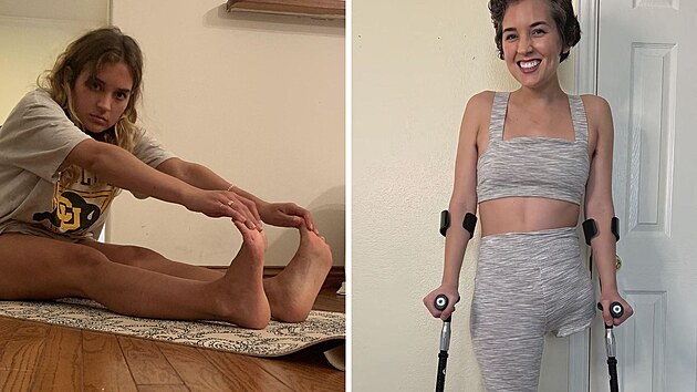 �ena skon�ila s amputovanou nohou.