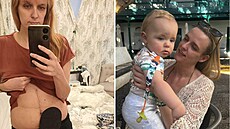 �ena m�la b�icho plné nádor�.