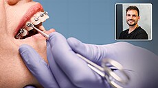 Jakub Hladík. Vedoucí léka� pra�ského stomatologického centra The Clinic.