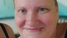 Lé�bu obezity na brn�nské SurGal Clinic podstoupila také Kristína Vébrová.