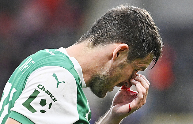 Havla návrat do Plzně bolel: Po srážce s Memičem jsem si cpal tampony do nosu