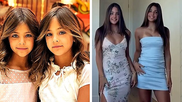 Nejhez�í dvoj�ata na sv�t�? Takhle vypadají dnes