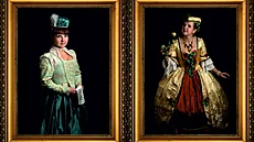 T�iapadesátiletá Dana z ji�ních �ech bojuje se záke�ným nádorem na mozku....