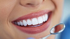 Ilustra�ní fotografie