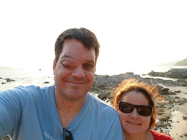 Děti se mu smály, že je Kyklop. Překonal šikanu i ztrátu oka, dnes šíří osvětu