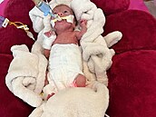 Verunka se narodila na hranici možného. Po pěti měsících si ji rodiče vzali domů