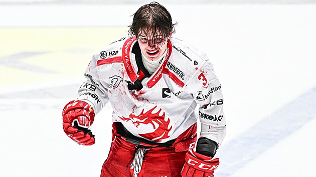 Kanlı Sikora kavga etti, Žabka seyircilerin arasına şişe fırlattı