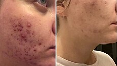Kate�ina na svém profilu na Instagramu sdílí pokroky, kterých dosáhla se svými...