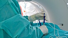 Léka�i z interven�ní radiologie Masarykova onkologického ústavu provedli...