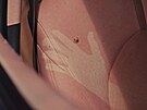 Tohle auto má bradavky. Ano, �tete správn�. Nejedná se o nepoda�ený tuning, ale...