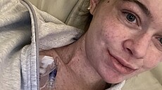 Jennifer Broyden z americké Virginie má extrémní alergii na slunce. Sta�í jí...