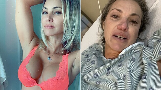 Kv�li praskl�mu silikonov�mu implant�tu m�la �ena velk� zdravotn� pot�e.