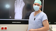 V chomutovské nemocnici se specializují na operace nohy a hlezna