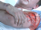Stalke�i z Resident Evilu
