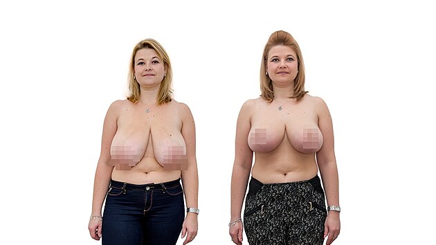 �ten��ka V�t�zslava podstoupila zmen�en� a n�slednou modelaci obou prs�.