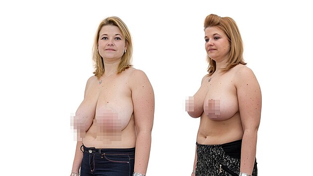 �ten��ka V�t�zslava podstoupila zmen�en� a n�slednou modelaci obou prs�.