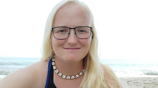 Vzácná a těžko poznatelná nemoc. Že může mít albinismus, žena zjistila až ve třiceti