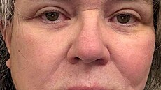 Rosie O�Donnellová po faceliftu (2026)
