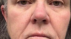 Rosie O�Donnellová p�ed faceliftem (2026)