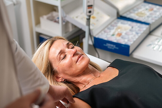 Akupunktura na migr�ny i nespavost: Kde m� ��nsk� medic�na smysl?