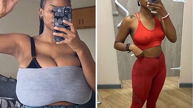 Michelle Sekwena pova�uje zmen�ení prsou za nejlep�í rozhodnutí v �ivot�.